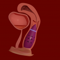 CodenameIlly 13I