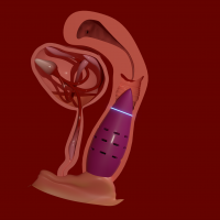 CodenameIlly 16I